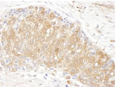 Immunohistochemistry (Formalin/PFA-fixed paraffin-embedded sections) - Anti-CCT3 antibody (AB176686)