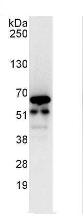 Immunoprecipitation - Anti-CCT3 antibody (AB176686), expandable thumbnail