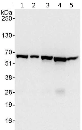 Western blot - Anti-CCT3 antibody (AB176686)