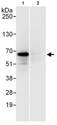 Immunoprecipitation - Anti-CCT3 antibody (AB225878)