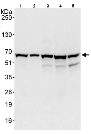Western blot - Anti-CCT3 antibody (AB225878)