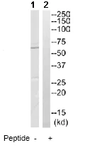 Western blot - Anti-CCT6A antibody (AB110905)