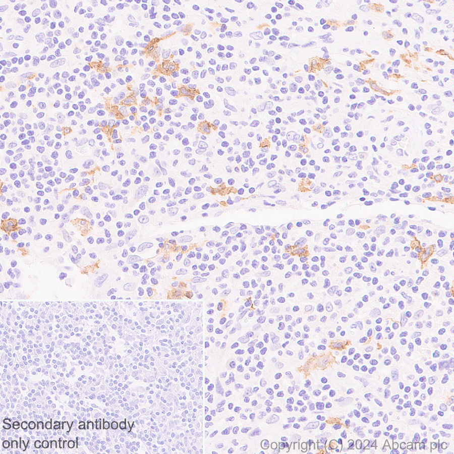 Immunohistochemistry (Formalin/PFA-fixed paraffin-embedded sections) - Anti-CCXCR1/XCR1 antibody [CIA207A] (AB317578)