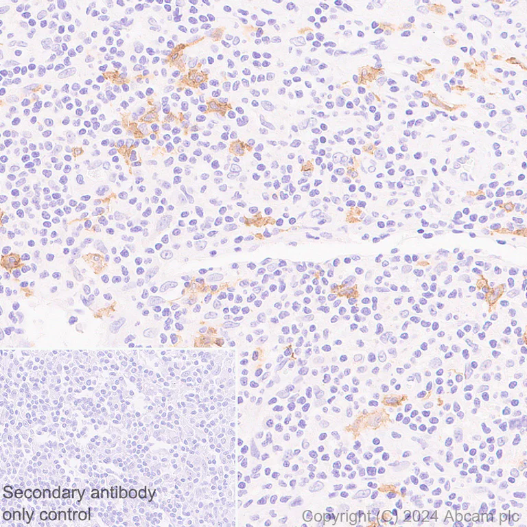 Immunohistochemistry (Formalin/PFA-fixed paraffin-embedded sections) - Anti-CCXCR1/XCR1 antibody [CIA207A] (AB317578)
