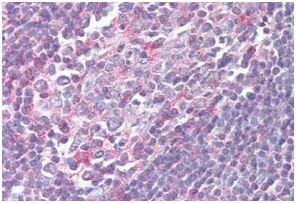 Immunohistochemistry (Formalin/PFA-fixed paraffin-embedded sections) - Anti-CCXCR1/XCR1 antibody - Cytoplasmic domain (AB188896)