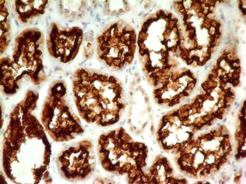 Immunohistochemistry (Formalin/PFA-fixed paraffin-embedded sections) - Anti-CD10 antibody [ABM4A52] (AB210932)