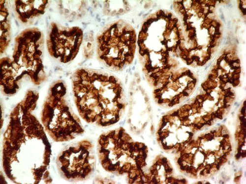 Immunohistochemistry (Formalin/PFA-fixed paraffin-embedded sections) - Anti-CD10 antibody [ABM4A52] (AB210932)