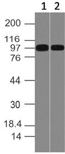 Western blot - Anti-CD10 antibody [ABM4A52] (AB210932)