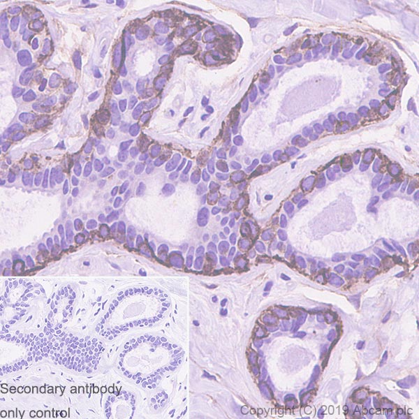 Immunohistochemistry (Formalin/PFA-fixed paraffin-embedded sections) - Anti-CD10 antibody [EPR22865-73] (ab255609), expandable thumbnail