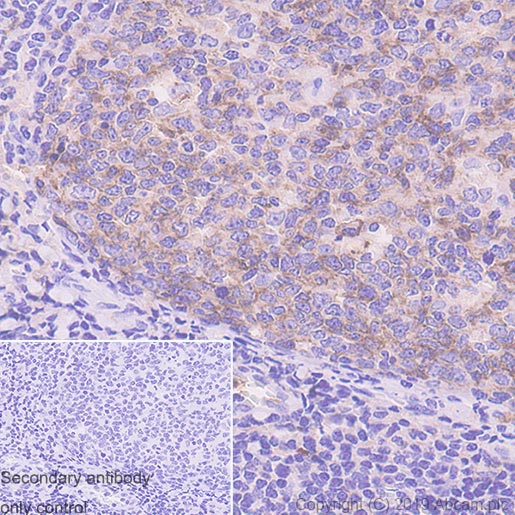 Immunohistochemistry (Formalin/PFA-fixed paraffin-embedded sections) - Anti-CD10 antibody [EPR22865-73] (ab255609), expandable thumbnail