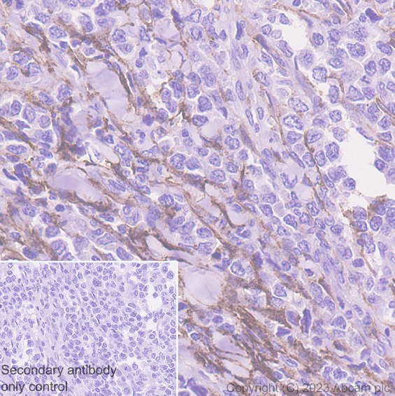 Immunohistochemistry (Formalin/PFA-fixed paraffin-embedded sections) - Anti-CD10 antibody [EPR22865-73] (ab255609), expandable thumbnail