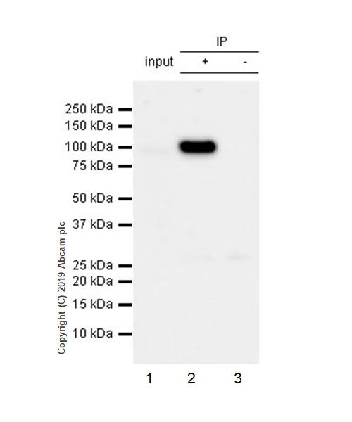 Immunoprecipitation - Anti-CD10 antibody [EPR22865-73] (AB255609), expandable thumbnail