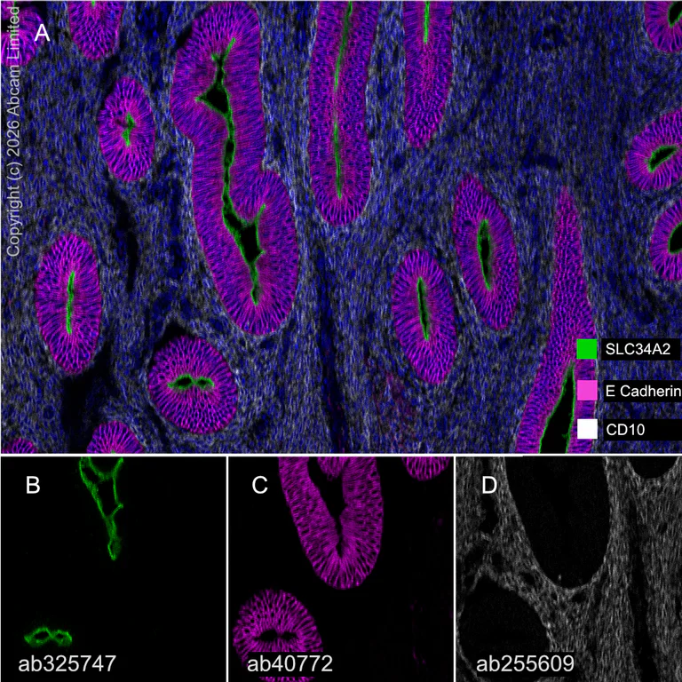 Multiplex immunohistochemistry - Anti-CD10 antibody [EPR22865-73] (AB255609)
