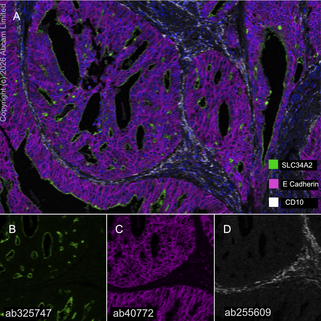 Multiplex immunohistochemistry - Anti-CD10 antibody [EPR22865-73] (AB255609)