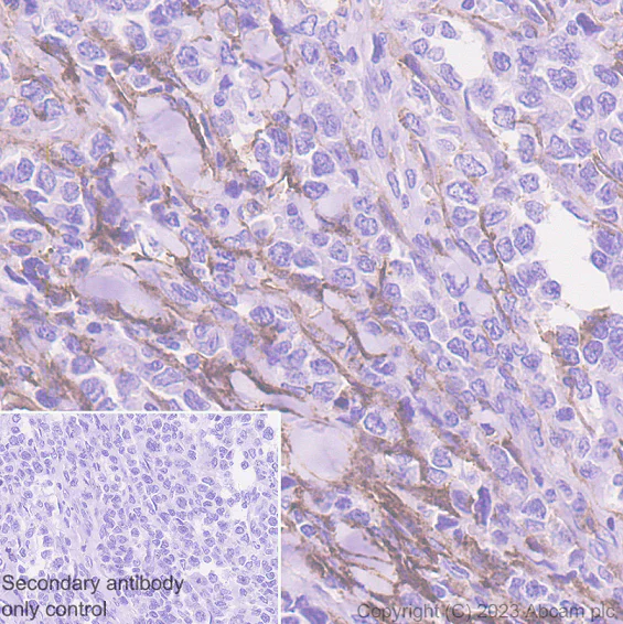 Immunohistochemistry (Formalin/PFA-fixed paraffin-embedded sections) - Anti-CD10 antibody [EPR22865-73] - BSA and Azide free (AB256767)
