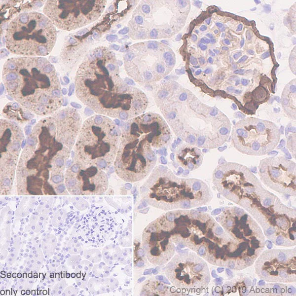 Immunohistochemistry (Formalin/PFA-fixed paraffin-embedded sections) - Anti-CD10 antibody [EPR22867-118] (AB256494)