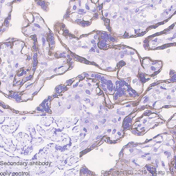 Immunohistochemistry (Formalin/PFA-fixed paraffin-embedded sections) - Anti-CD10 antibody [EPR22867-118] (AB256494)