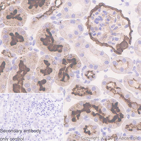 Immunohistochemistry (Formalin/PFA-fixed paraffin-embedded sections) - Anti-CD10 antibody [EPR22867-118] - BSA and Azide free (ab261729), expandable thumbnail