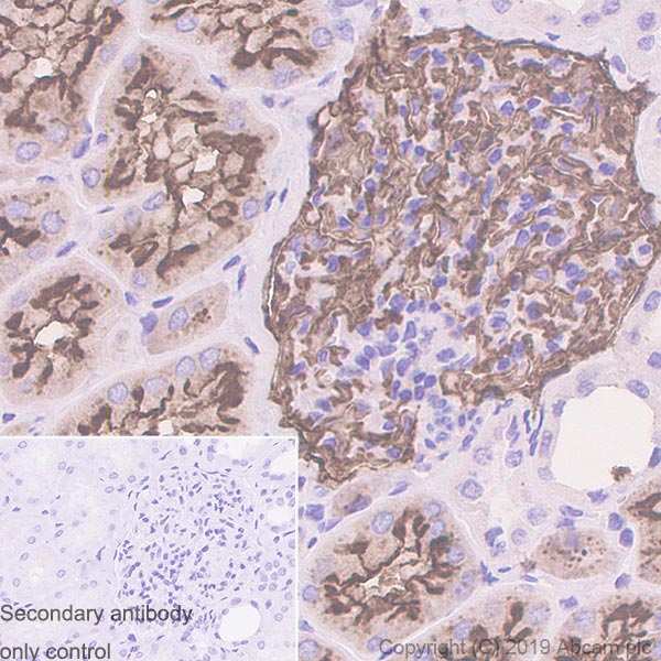 Immunohistochemistry (Formalin/PFA-fixed paraffin-embedded sections) - Anti-CD10 antibody [EPR22867-118] - BSA and Azide free (ab261729), expandable thumbnail