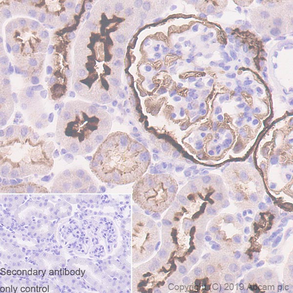 Immunohistochemistry (Formalin/PFA-fixed paraffin-embedded sections) - Anti-CD10 antibody [EPR22867-118] - BSA and Azide free (ab261729), expandable thumbnail