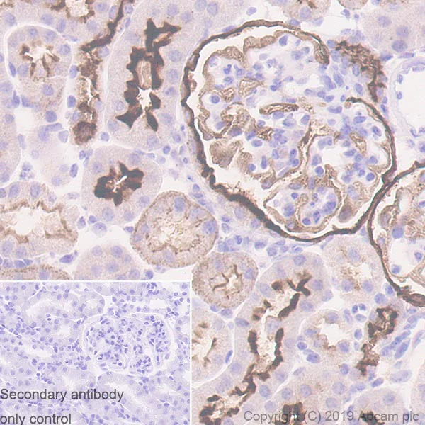 Immunohistochemistry (Formalin/PFA-fixed paraffin-embedded sections) - Anti-CD10 antibody [EPR22867-118] - BSA and Azide free (AB261729)
