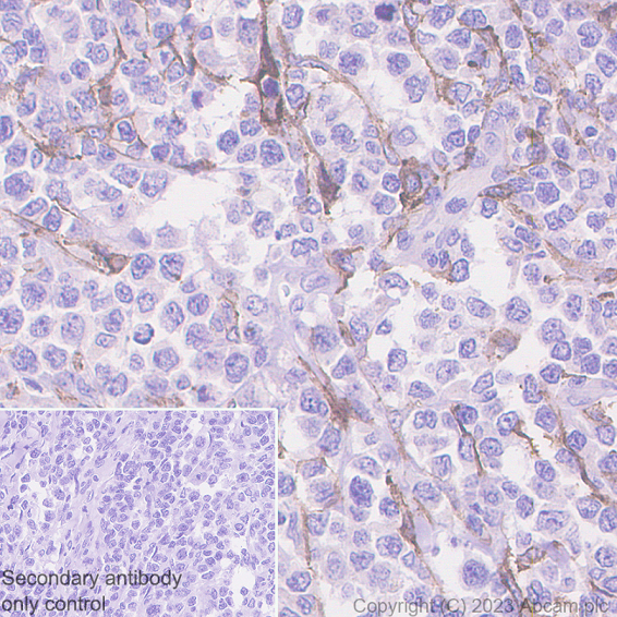 Immunohistochemistry (Formalin/PFA-fixed paraffin-embedded sections) - Anti-CD10 antibody [EPR22867-118] - BSA and Azide free (ab261729), expandable thumbnail