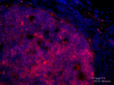 Immunohistochemistry (Formalin/PFA-fixed paraffin-embedded sections) - Anti-CD10 antibody [EPR22867-118] - BSA and Azide free (ab261729), expandable thumbnail