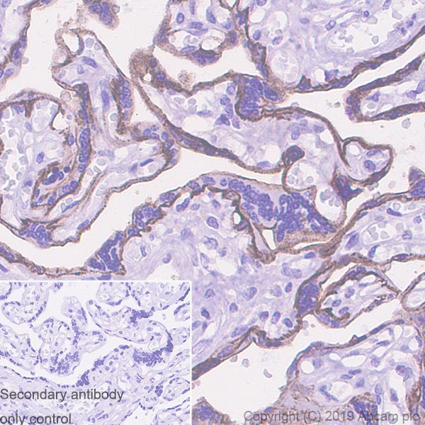 Immunohistochemistry (Formalin/PFA-fixed paraffin-embedded sections) - Anti-CD10 antibody [EPR22867-118] - BSA and Azide free (ab261729), expandable thumbnail