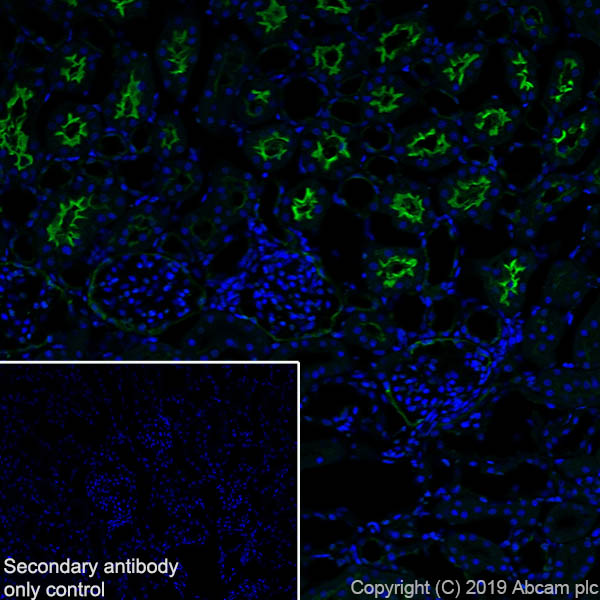 Immunohistochemistry (Frozen sections) - Anti-CD10 antibody [EPR22867-118] - BSA and Azide free (AB261729), expandable thumbnail