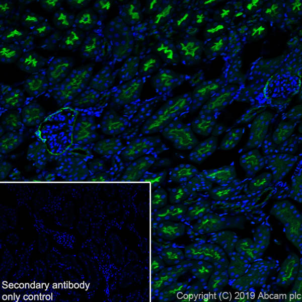 Immunohistochemistry (Frozen sections) - Anti-CD10 antibody [EPR22867-118] - BSA and Azide free (AB261729), expandable thumbnail