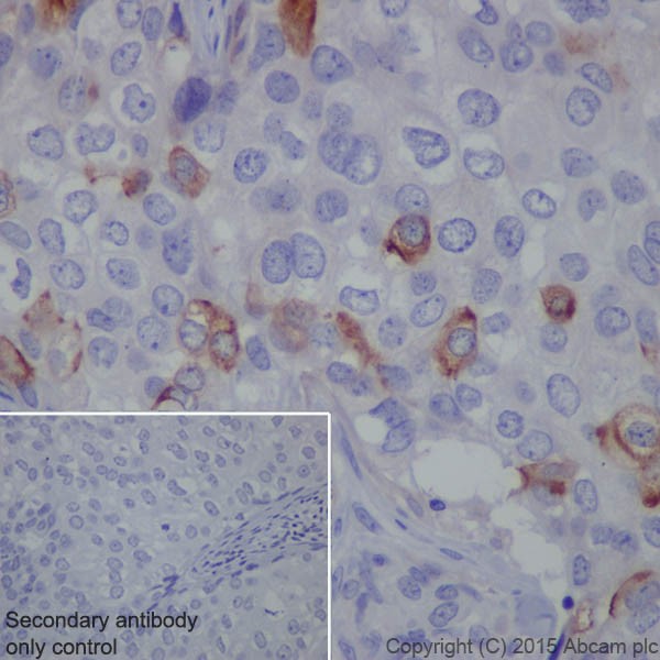 Immunohistochemistry (Formalin/PFA-fixed paraffin-embedded sections) - Anti-CD10 antibody [EPR5904-110] - BSA and Azide free (AB271985), expandable thumbnail