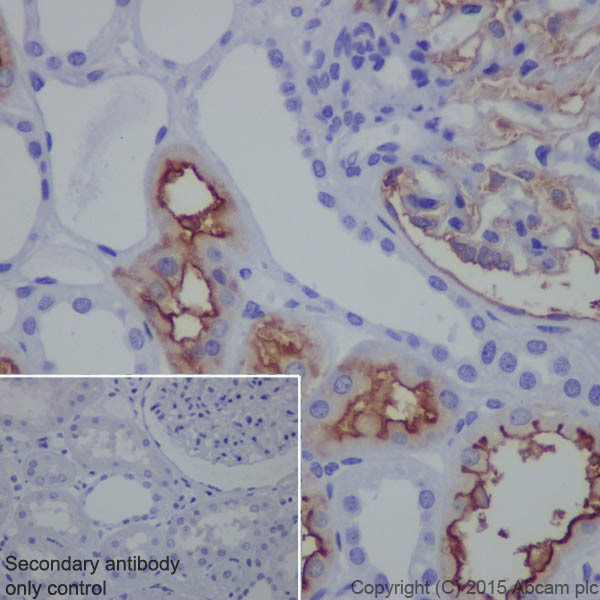 Immunohistochemistry (Formalin/PFA-fixed paraffin-embedded sections) - Anti-CD10 antibody [EPR5904-110] - BSA and Azide free (AB271985), expandable thumbnail
