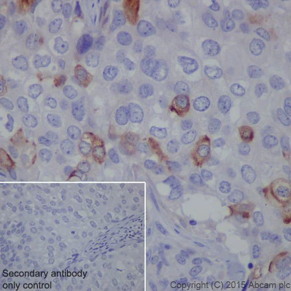 Immunohistochemistry (Formalin/PFA-fixed paraffin-embedded sections) - Anti-CD10 antibody [EPR5904-110] - Low endotoxin, Azide free (AB222225)
