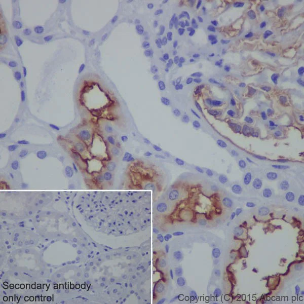 Immunohistochemistry (Formalin/PFA-fixed paraffin-embedded sections) - Anti-CD10 antibody [EPR5904-110] - Low endotoxin, Azide free (AB222225)