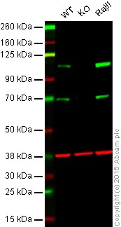 Western blot - Anti-CD10 antibody [EPR5904-110] - Low endotoxin, Azide free (AB222225)