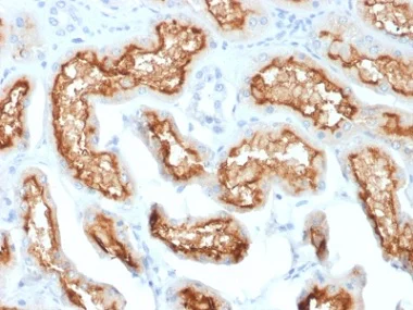 Immunohistochemistry (Formalin/PFA-fixed paraffin-embedded sections) - Anti-CD10 antibody [MME/1870] - BSA and Azide free (AB237865)