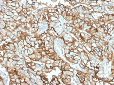 Immunohistochemistry (Formalin/PFA-fixed paraffin-embedded sections) - Anti-CD10 antibody [MME/1870] - BSA and Azide free (AB237865)