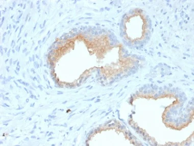 Immunohistochemistry (Formalin/PFA-fixed paraffin-embedded sections) - Anti-CD10 antibody [MME/1870] - BSA and Azide free (AB237865)