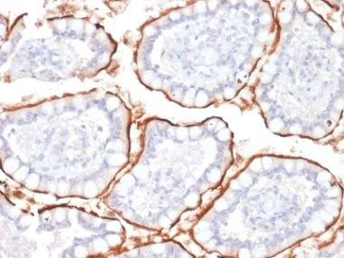 Immunohistochemistry (Formalin/PFA-fixed paraffin-embedded sections) - Anti-CD10 antibody [MME/1870] - BSA and Azide free (AB237865)