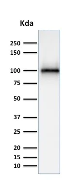 Western blot - Anti-CD10 antibody [MME/1870] - BSA and Azide free (AB237865)