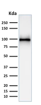 Western blot - Anti-CD10 antibody [MME/1892] - BSA and Azide free (AB237866)