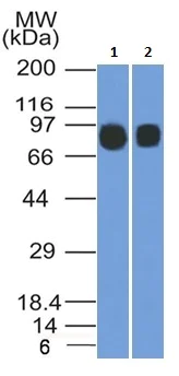 Western blot - Anti-CD10 antibody [MME/1892] - BSA and Azide free (AB237866)
