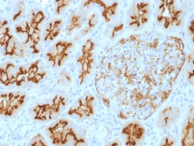 Immunohistochemistry (Formalin/PFA-fixed paraffin-embedded sections) - Anti-CD10 antibody [MME/1893] (AB238023), expandable thumbnail