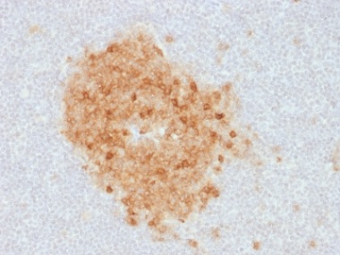 Immunohistochemistry (Formalin/PFA-fixed paraffin-embedded sections) - Anti-CD10 antibody [MME/1893] (AB238023), expandable thumbnail