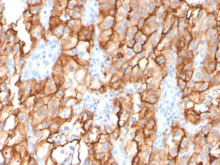 Immunohistochemistry (Formalin/PFA-fixed paraffin-embedded sections) - Anti-CD10 antibody [MME/2579] (AB270722)
