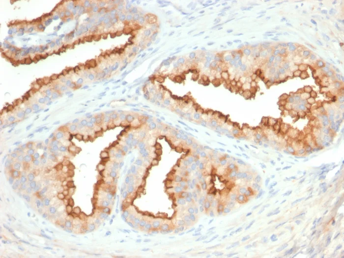 Immunohistochemistry (Formalin/PFA-fixed paraffin-embedded sections) - Anti-CD10 antibody [MME/2579] (AB270722)