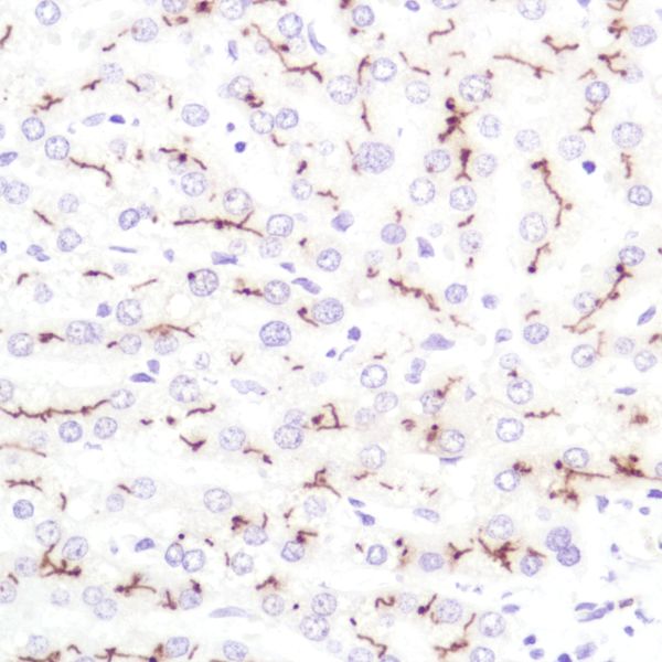 Immunohistochemistry (Formalin/PFA-fixed paraffin-embedded sections) - Anti-CD10 antibody [SP179] - BSA and Azide free (ab243934), expandable thumbnail