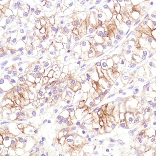 Immunohistochemistry (Formalin/PFA-fixed paraffin-embedded sections) - Anti-CD10 antibody [SP179] - BSA and Azide free (ab243934), expandable thumbnail
