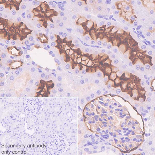Immunohistochemistry (Formalin/PFA-fixed paraffin-embedded sections) - Anti-CD10 antibody [SP179] - BSA and Azide free (AB243934), expandable thumbnail