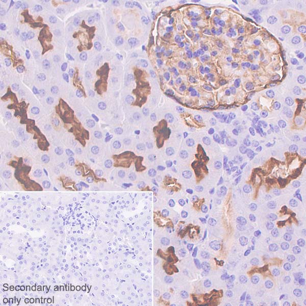 Immunohistochemistry (Formalin/PFA-fixed paraffin-embedded sections) - Anti-CD10 antibody [SP179] - BSA and Azide free (AB243934), expandable thumbnail